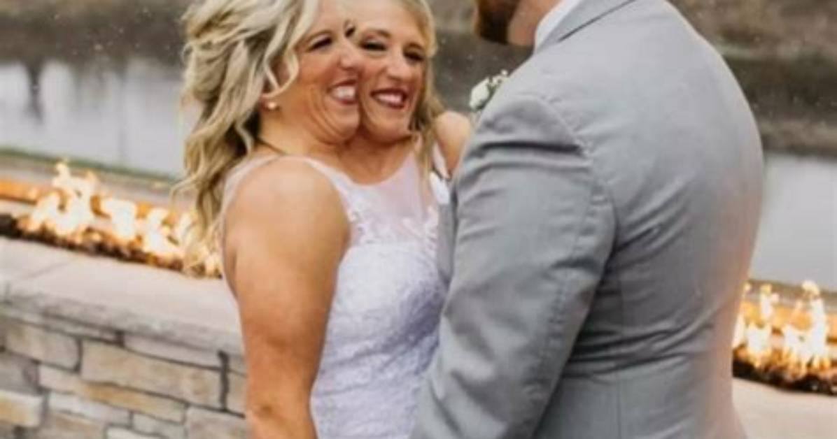 Abby and Brittany Hensel Bio, Are They Married or Engaged? Here Are Facts