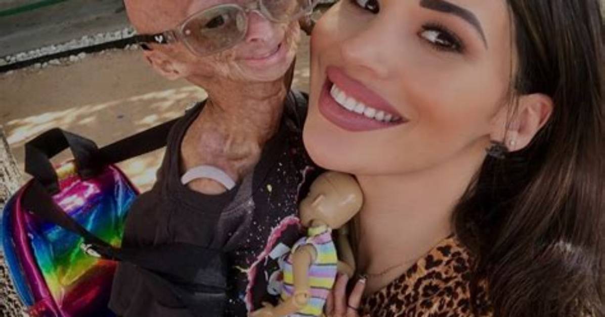 Adalia Rose Father Ryan Pallante and Mother Natalie Pallante – Are They Her Biological Parents?