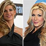 Alexis Maloney Before and After Photos- Plastic Surgery Details