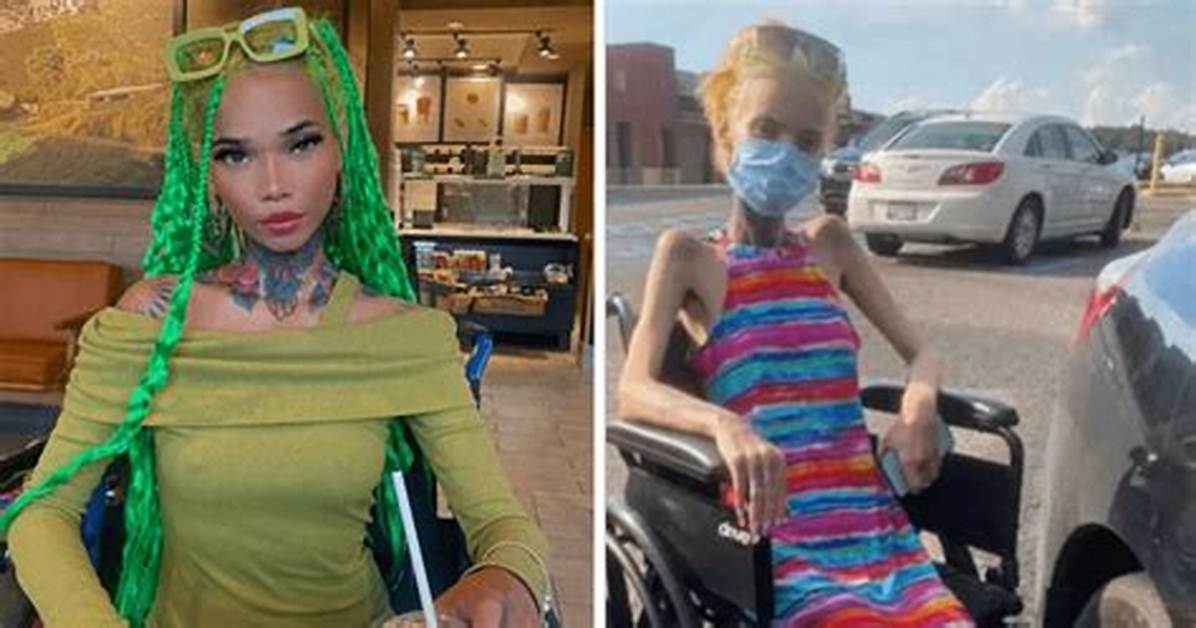 All About Ig Model Gena Tew: Aids Diagnosis Update