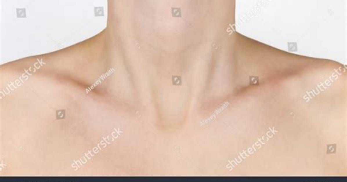 Are Visible Collarbones Genetic