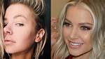 Ariana Madix Nose Job: Before and After Plastic Surgery