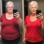 Atkins Estimond Weight Loss Before and After; Family and Net Worth