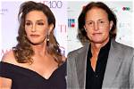 Caitlyn Jenner (Bruce Jenner) – Net Worth, Surgery & Gay Marriage