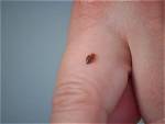 Can Chiggers Live Inside Your House