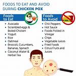 Can We Eat Egg in Chicken Pox