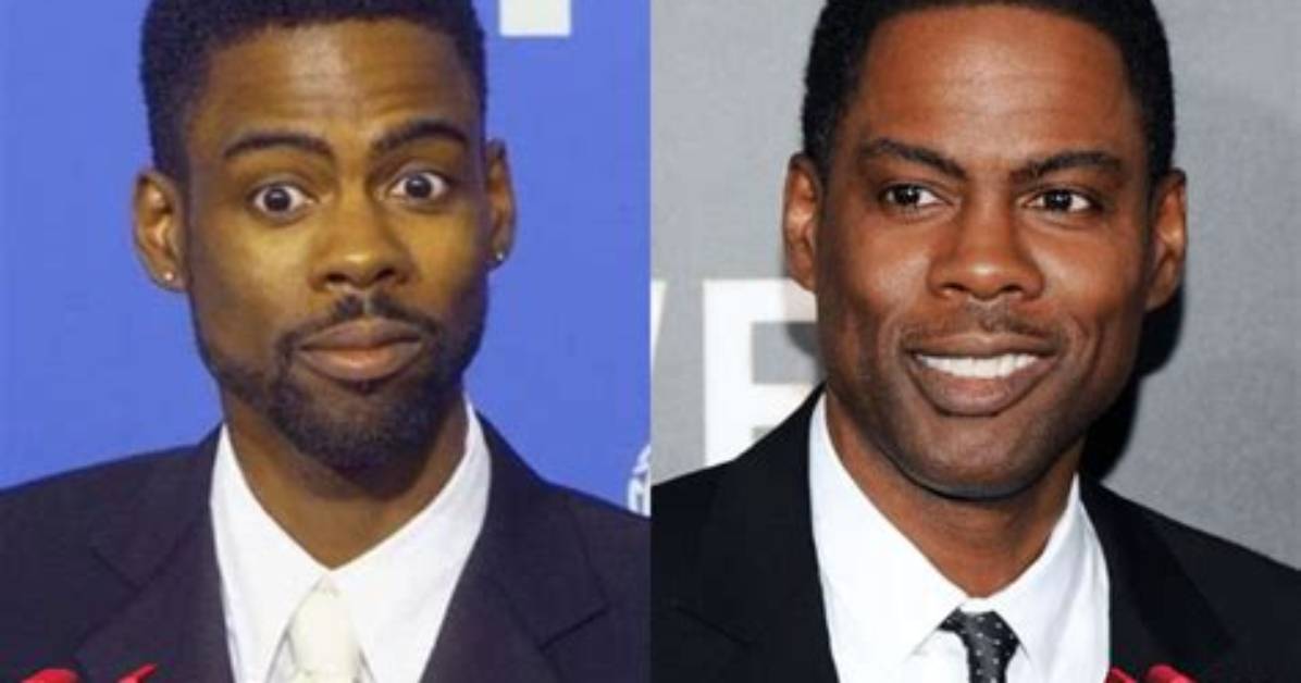 Chris Rock’s Plastic Surgery: Before and After Face Surgery in 2022!