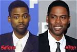 Chris Rock’s Plastic Surgery: Before and After Face Surgery in 2022!
