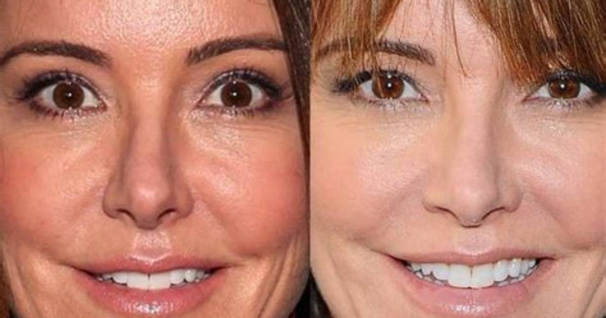 Christa Miller Plastic Surgery: What Happened to Her Face in Head of the Class?