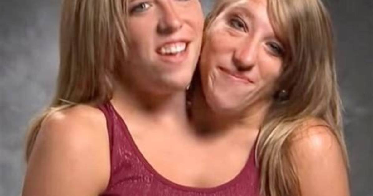 Conjoined Twins Abby and Brittany Hensel Family