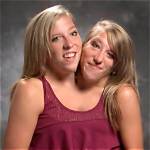Conjoined Twins Abby and Brittany Hensel Family