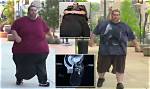 Dan Maurer Update Today – Before & After Surgery, His Death Hoax Debunked