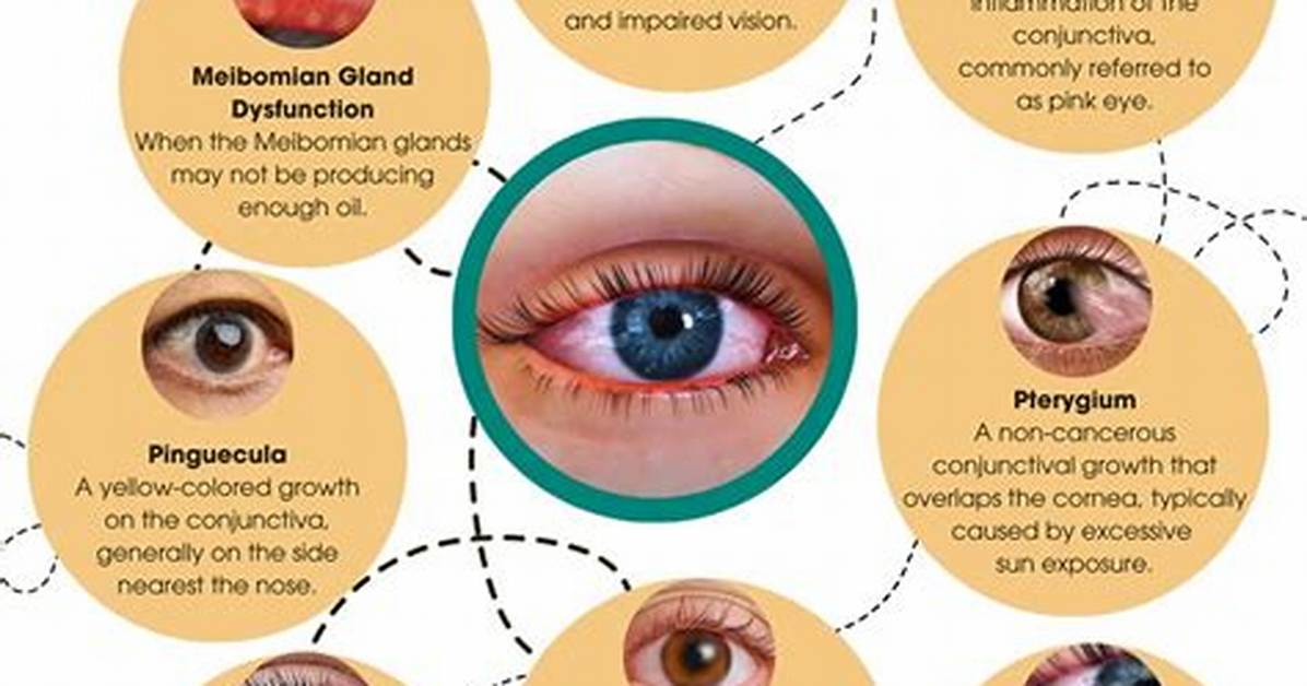 David Jonsson Eye Condition: Illness and Health Update 2023
