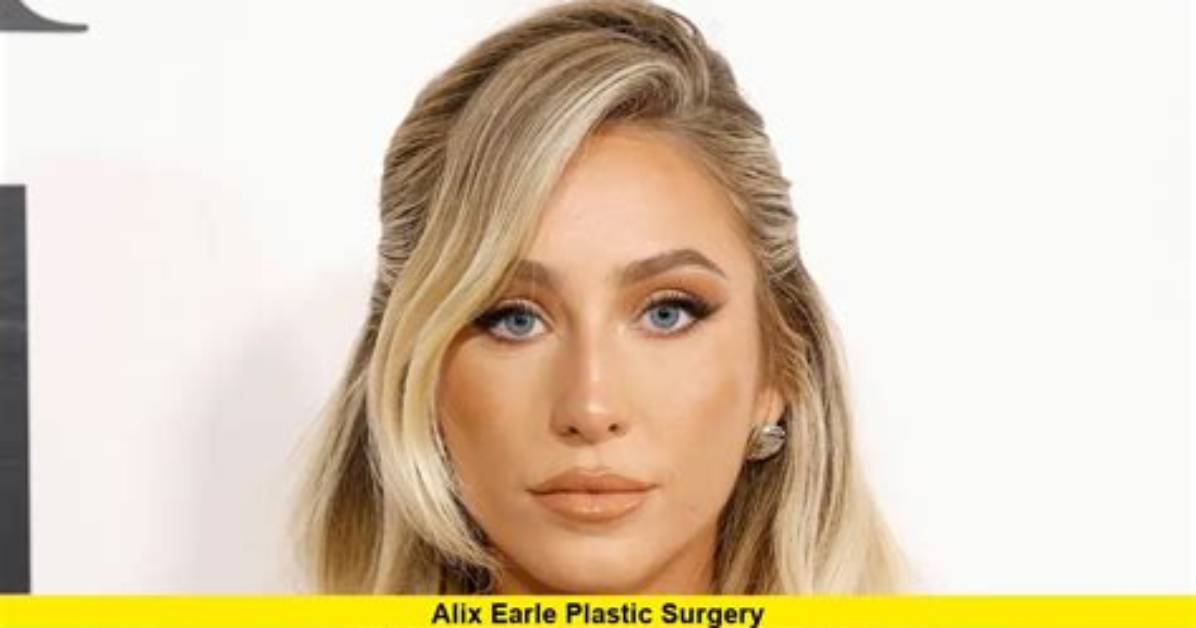 Did Alix Earle Undergo Plastic Surgery?