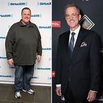 Did Billy Gardell Have Weight Loss Surgery- How Much Weight Did He Lose?