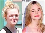 Did Elle Fanning Undergo Surgery? Find the Actress’ Before and After Pictures