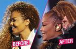 Did Janet Devlin Get a Plastic Surgery? Before and After Photos