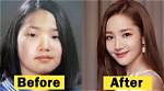 Did Yeonmi Park Had a Plastic Surgery? Is She Fake? Husband, Son and Instagram
