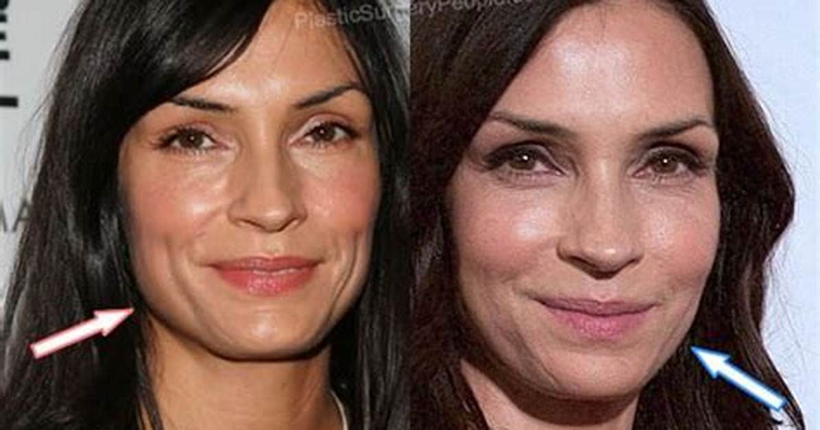 Famke Janssen’s Plastic Surgery: Did the Poison Rose Cast Have Botox, Fillers, and a Facelift as Fans Claim? Look at the Before and After Pictures!