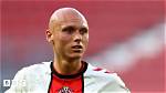 Footballer: What Happened to Will Smallbone Hair? Illness Alopecia -Details to Know