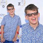 Gavin Mchugh Bio, Wiki, Age, Height, Family, Cerebral Palsy, Actor and Net Worth