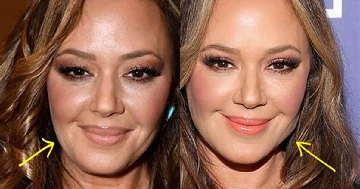 Has Leah Remini Had Plastic Surgery? What Happened to Her Face?