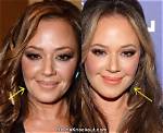 Has Leah Remini Had Plastic Surgery? What Happened to Her Face?