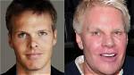 Has Mike Jeffries Had Plastic Surgery?