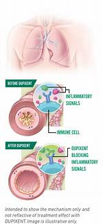 How Does Dupixent Work