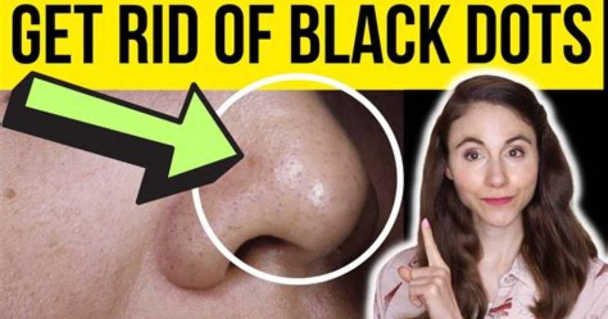 How to Get Rid of Black Stuff in Cats Ears