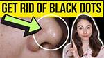 How to Get Rid of Black Stuff in Cats Ears
