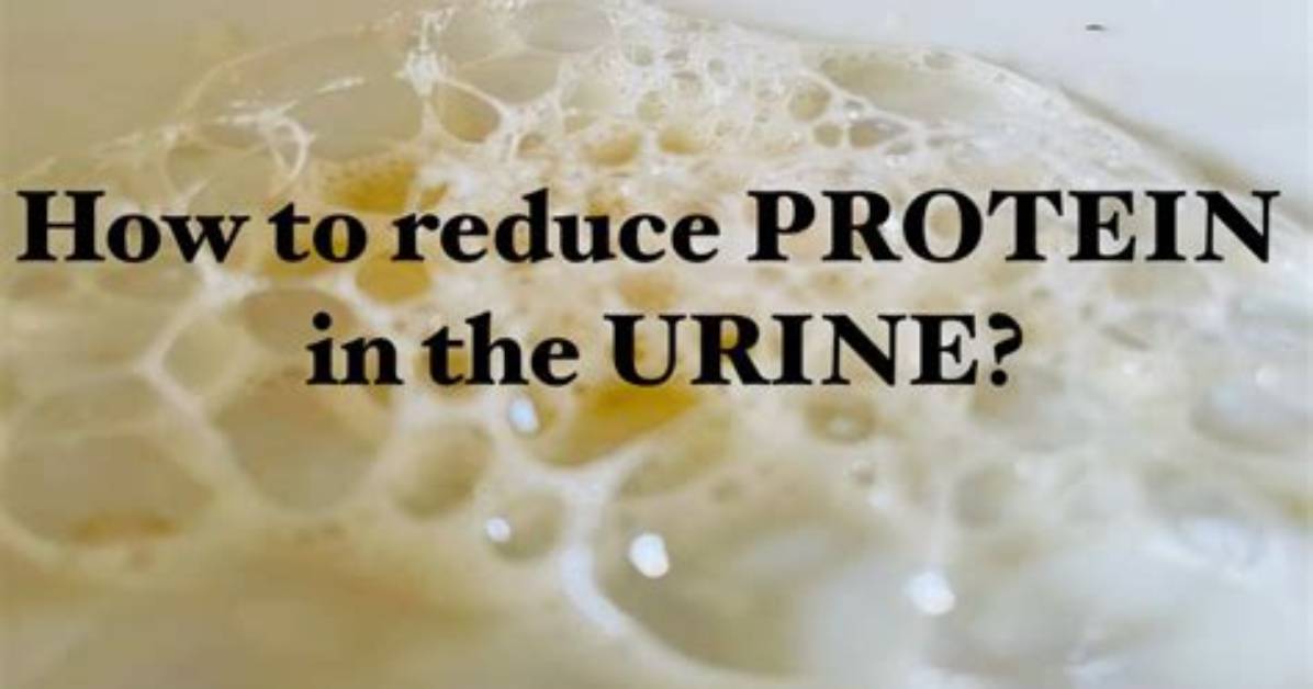 How to Get Rid of Protein in Urine