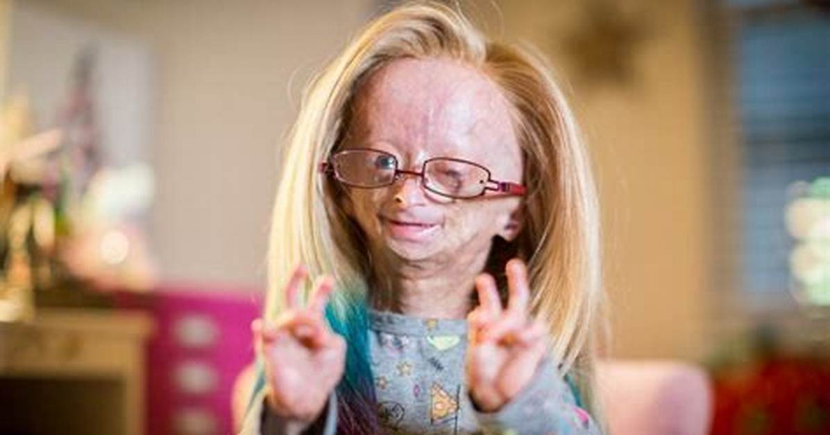 Is Adalia Rose Still Alive or Dead? Wikipedia and Age – as a Baby Photos