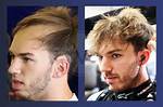 Is Pierre Gasly Bald Now? What Happened to His Hair? Health Update
