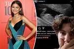 Is Zendaya Pregnant? ?