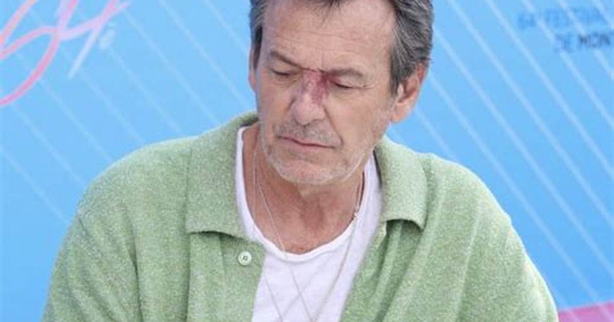 Jean Luc Reichmann Accident Update: What Happened to Him? Where Is He Now?