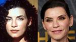 Julianna Margulies Doesn’t Look Natural After Plastic Surgery!