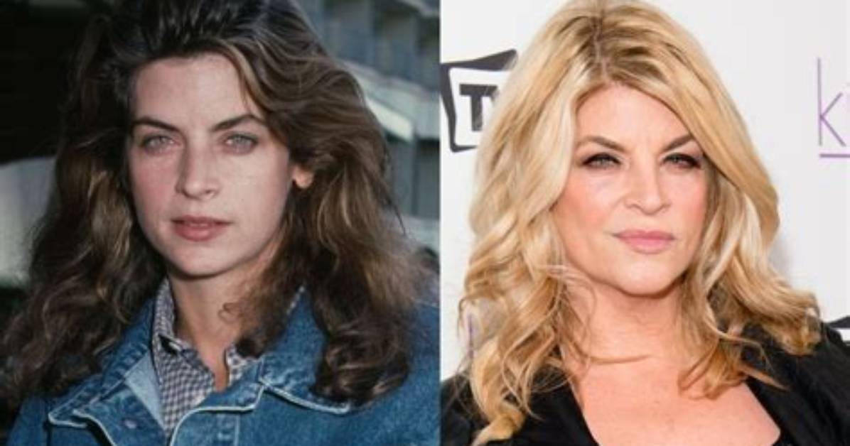 Kirstie Alley’s Plastic Surgery: Did the Cheers Star Have Botox and a Facelift?