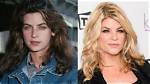 Kirstie Alley’s Plastic Surgery: Did the Cheers Star Have Botox and a Facelift?
