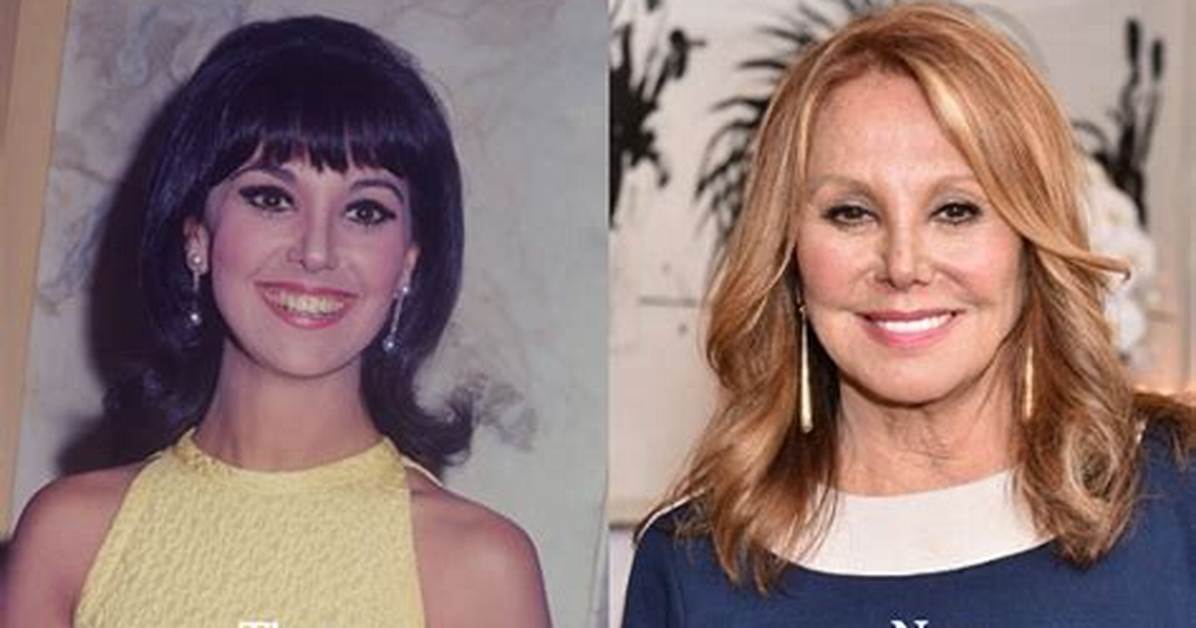 Know About Marlo Thomas Face Lift: Plastic Surgery Before and After, Kids and Husband