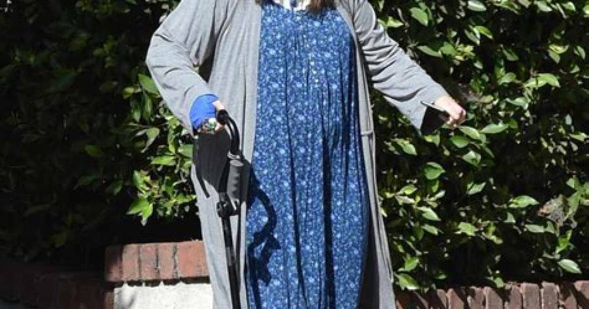 Lena Dunham Illness & Ehlers-Danlos Syndrome: What Happened to the Actress-Writer?