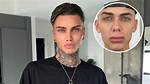Levi Jed Murphy Before Surgery Photos and Boyfriend: Everything on Levijedmurphy Tiktok Star