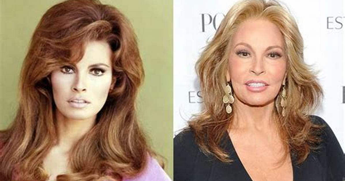Raquel Welch’s Plastic Surgery: Did the Actress Have Cosmetic Surgery to Look Young? Did She Have Breast Implants?