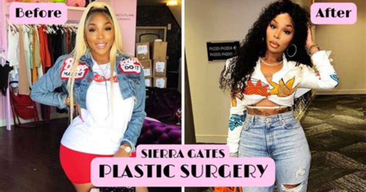 Sierra Gates Before Plastic Surgery – Is She Related to Kevin Gates?