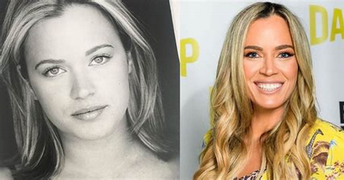 Teddi Mellencamp’s Before and After Necklift Pics Show Why She Hated the Surgery