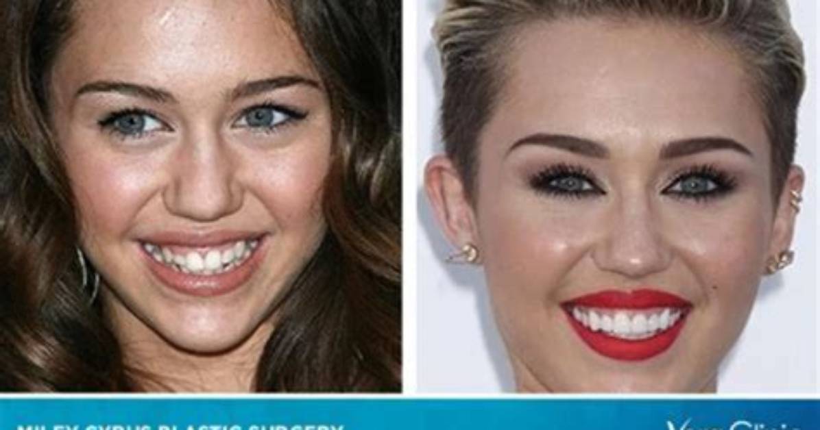 Tish Cyrus Plastic Surgery | Before and After Photos