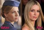 Truth About Annabelle Wallis Nose Job