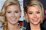 Vanderpump Rules Ariana Madix Nose Job Before and After Photos