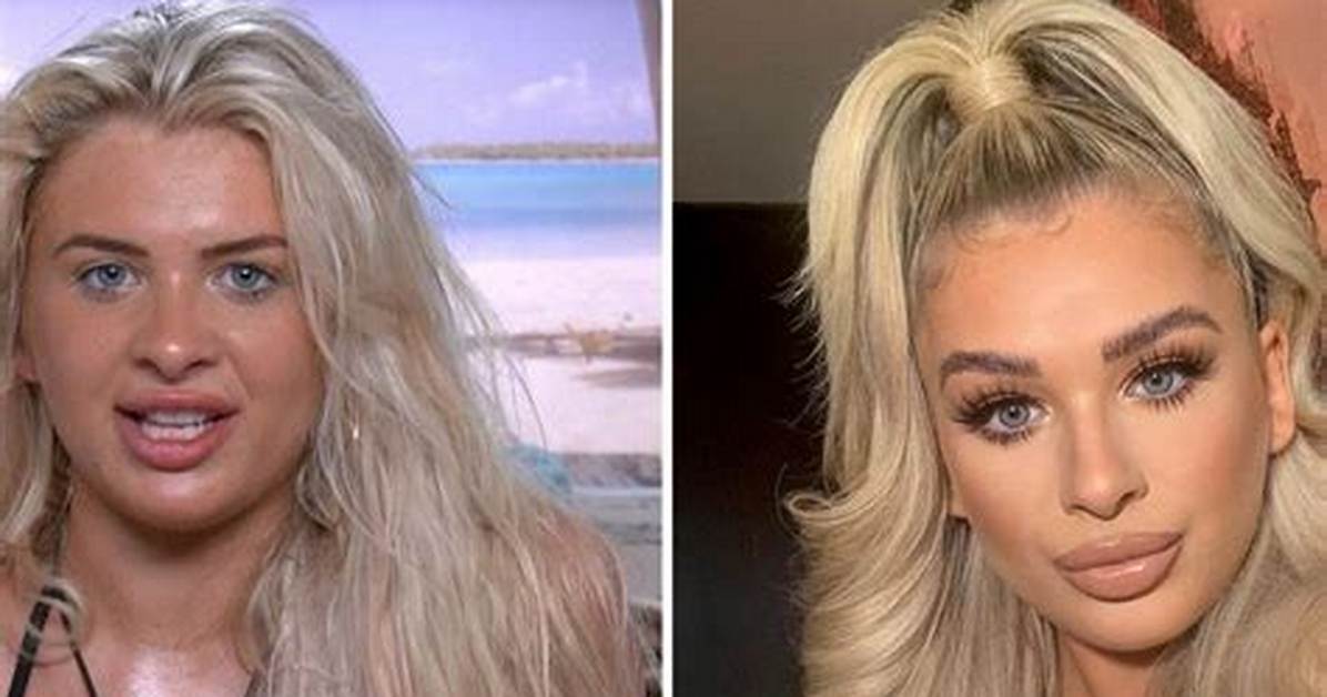 What Did Liberty Poole Look Like Before Surgery? Pictures with Mum Jo on Instagram