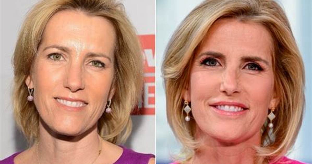 What Happened to Laura Ingraham Face? Face Lift and Plastic Surgery Update